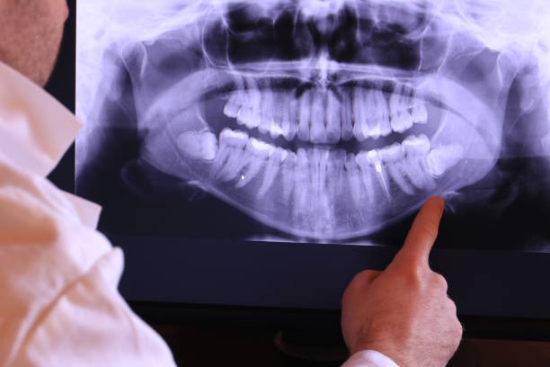 Best Teeth Whitening  in Temperance, MI